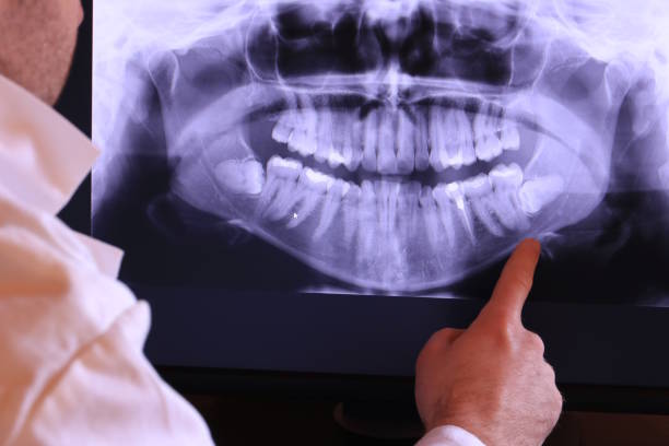 Teeth Whitening in ID